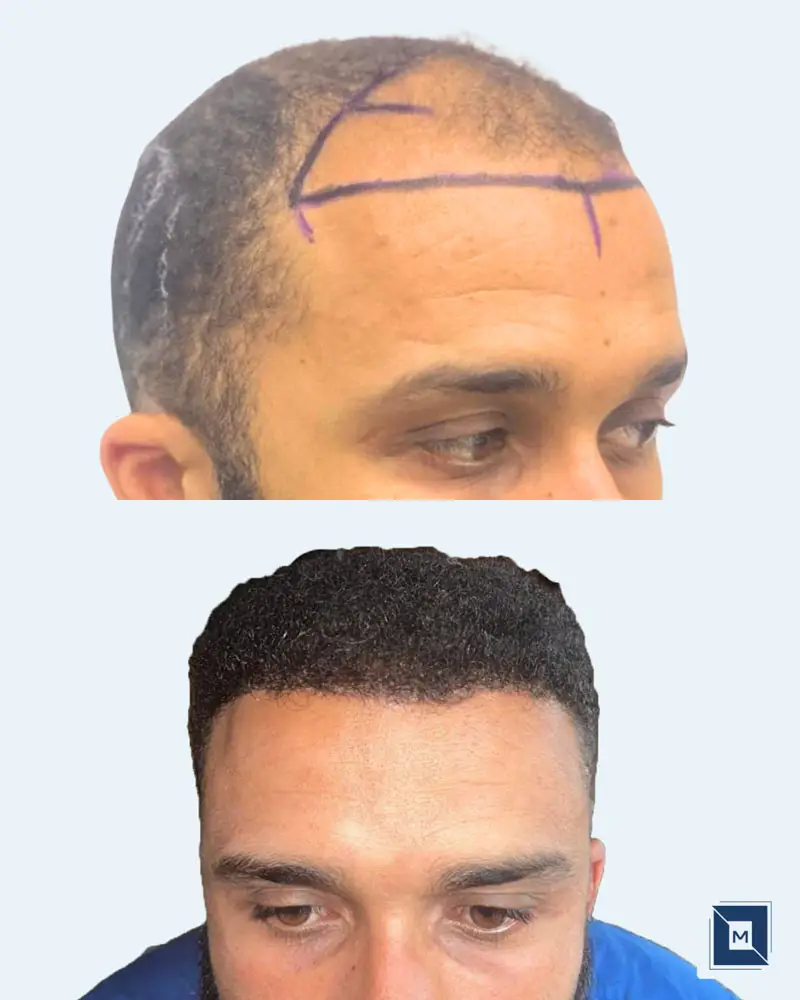 Minimalist Before After Salon & Makeup Instagram Post - Before &