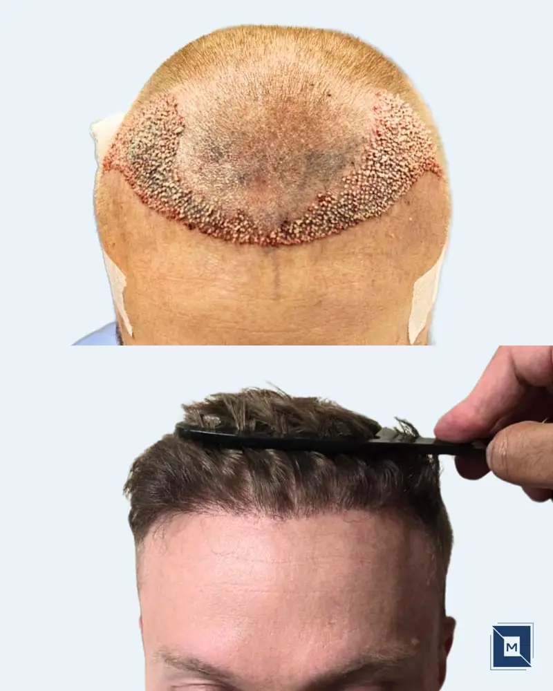 Minimalist Before After Salon & Makeup Instagram Post - Before &