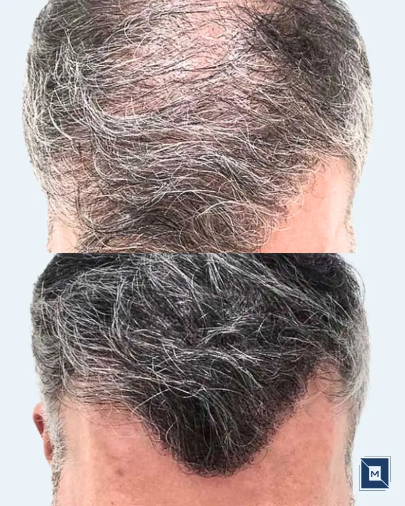 Minimalist Before After Salon & Makeup Instagram Post - Before &