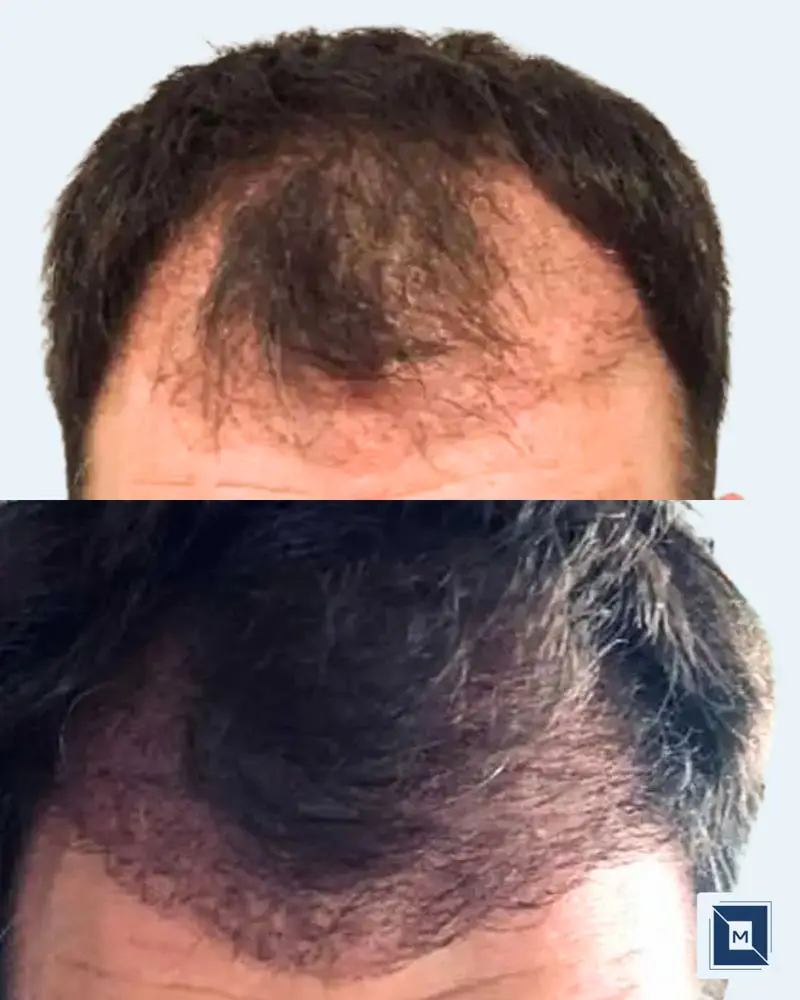 Minimalist Before After Salon & Makeup Instagram Post - Before &