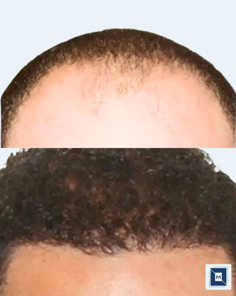 Minimalist Before After Salon & Makeup Instagram Post - Before &